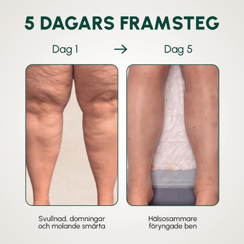 HealWrap – Benmassageapparat för Smärtlindring och Avslappning - Komforten