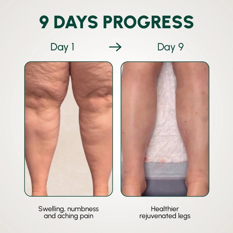 HealWrap™ Leg Massage Device for Pain Relief and Relaxation - Komforten